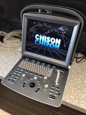 Chison Eco 5 Mobiles Ultraschall