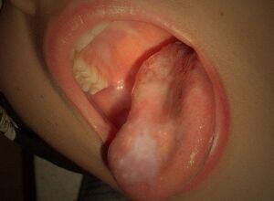 Blowjob date.
